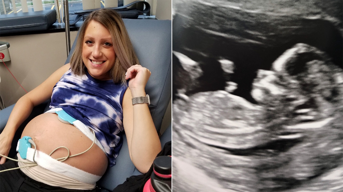 Two years after going through injections to preserve her fertility, Brittney was pregnant.