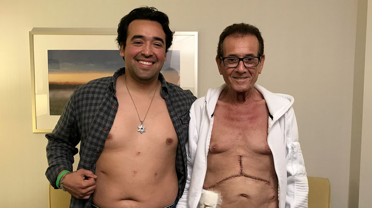 With the laparoscopic donor surgery, Nikko has four small incisions on his abdomen. (Courtesy: Cleveland Clinic)