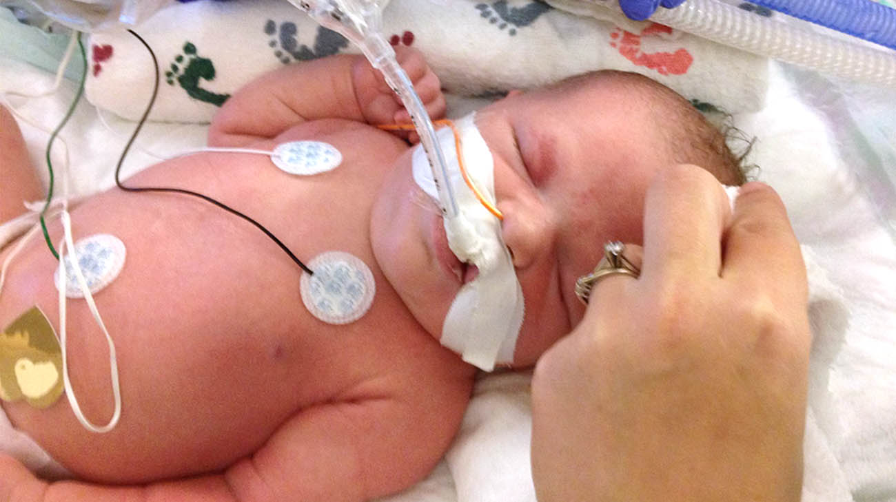 Lucy was diagnosed with hypoxic ischemic encephalopathy shortly after birth. 