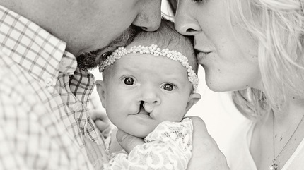 Charlotte gets kisses from her mom and dad. (Courtesy: Ashley Lindeman Photography)
