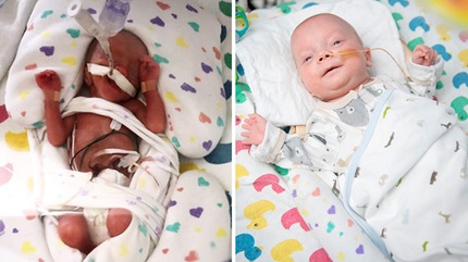 Patrick weighed just over a pound when he was born at 24 weeks and 3 days gestation. (Courtesy: Meghan LaFraniere and Cleveland Clinic)