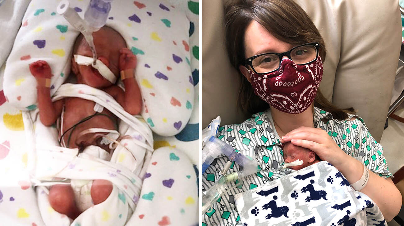 Patrick was on a ventilator during his first days in the NICU, while his lungs continued to develop. (Courtesy: Patrick LaFraniere)(Courtesy