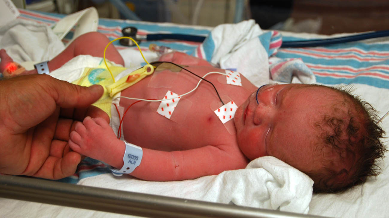 Doctors diagnosed Liam with a congenital heart defect known as a ventricular septal defect (VSD).