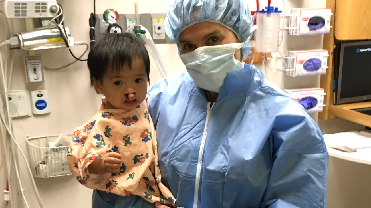 Dr. Bassiri-Gharb was able to modify the bilateral cleft lip and palate repair to achieve life-changing results.