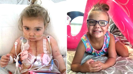 Alivia underwent a heart transplant after doctors diagnosed her with aortic coarctation. 