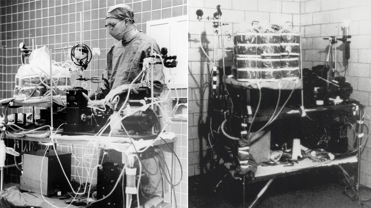 A heart-lung machine, developed by Willem Kolff, MD, kept Kevin alive during the operation. (Courtesy: Cleveland State University)