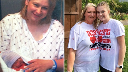 Mother and daughter, Denise and Ashton, were both diagnosed with the same heart condition. 