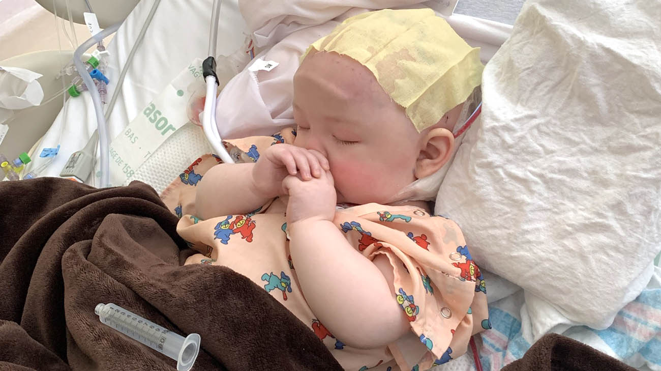 Charlotte required open cranial surgery to treat her sagittal craniosynostosis.