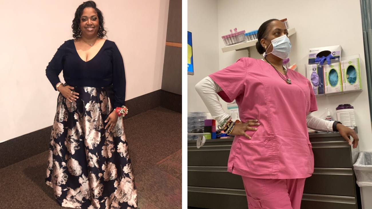Chanona Williams before (left) starting the Bariatric Medical Weight Loss Program and after (right).