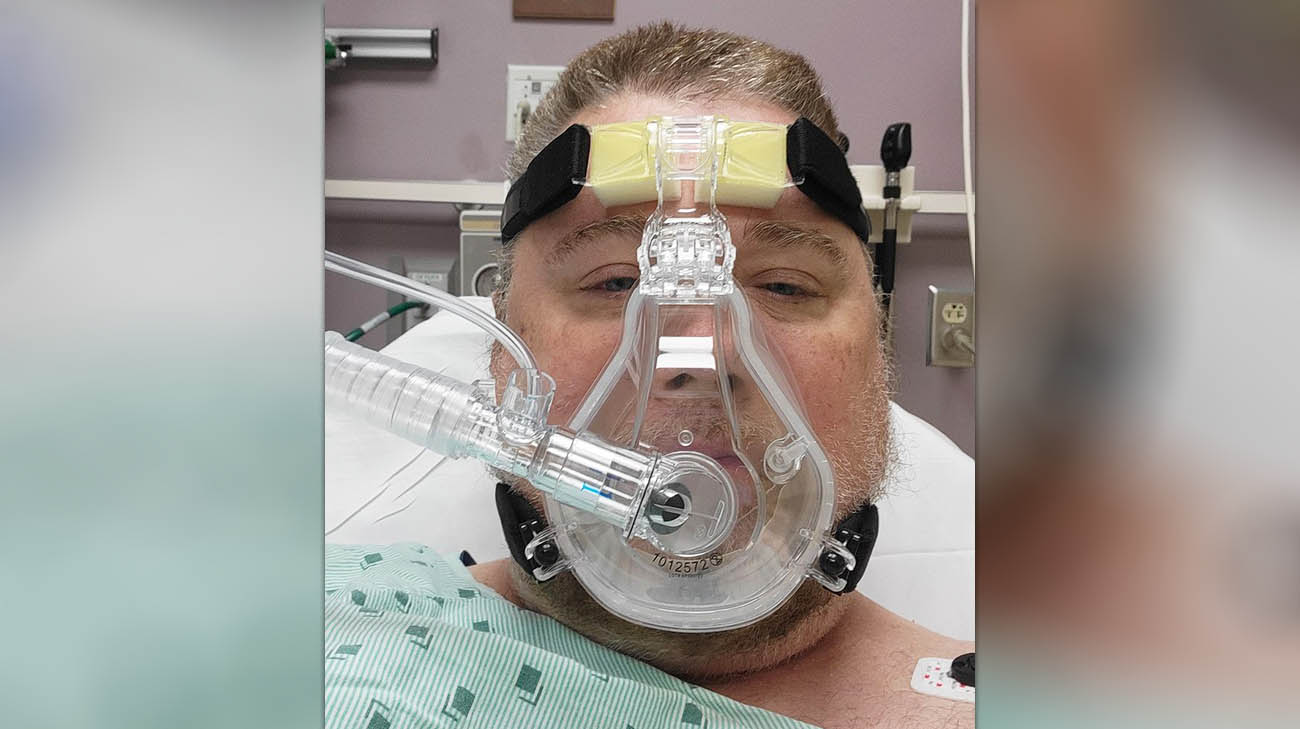 After being diagnosed with COVID-19, Bob used a CPAP before he was put on a ventilator. 