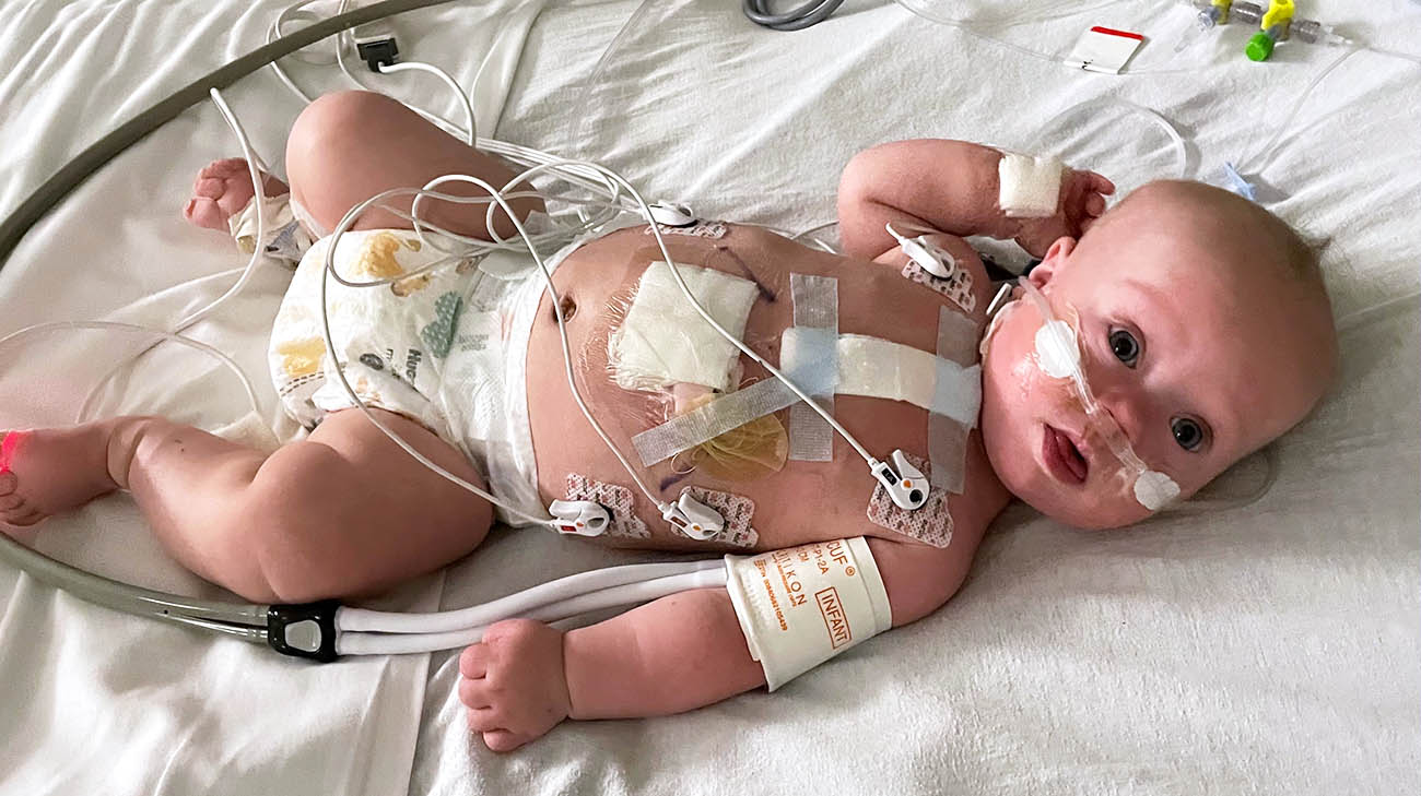 Weston after undergoing a heart procedure to repair a congenital heart defect at Cleveland Clinic Children's. 