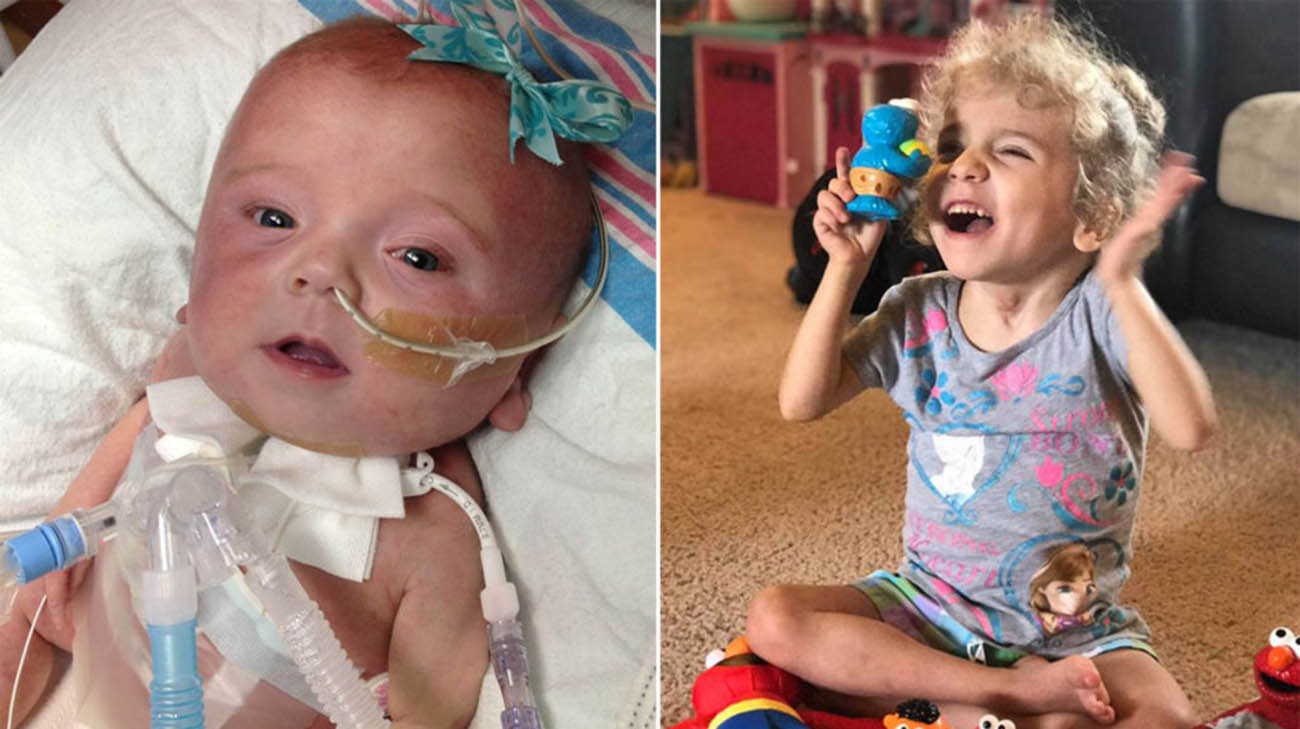 Jacoby Arnold was born with a life-threatening condition called hydrops fetalis. 