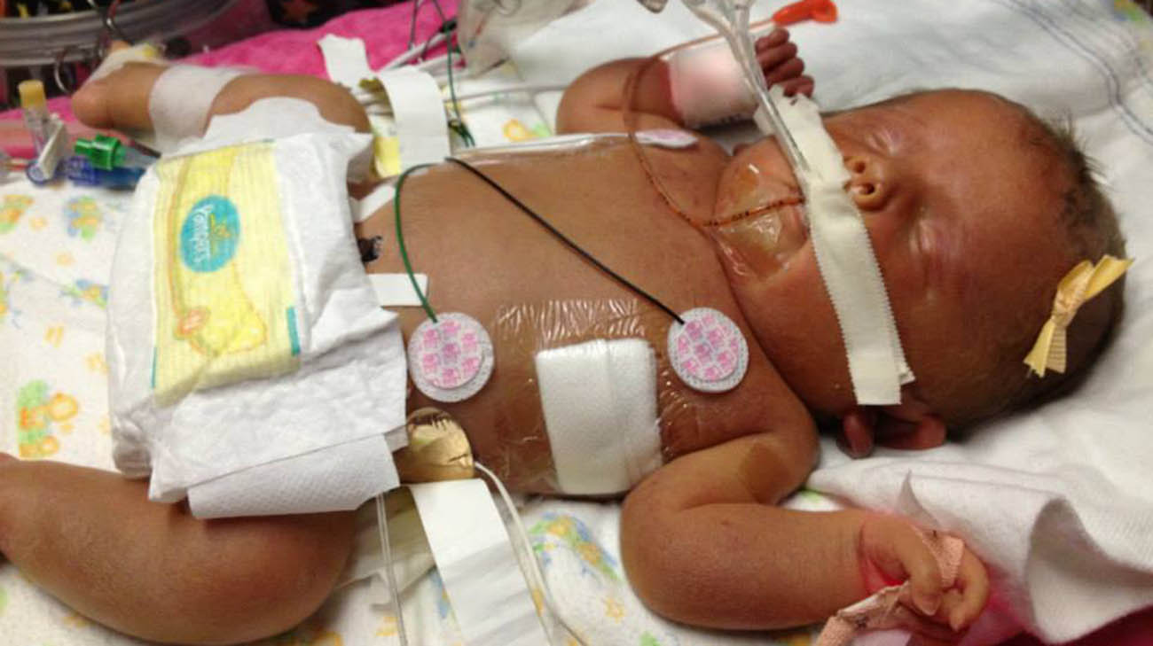 Baby in NICU Thrives After Given 5 Percent Chance to Survive