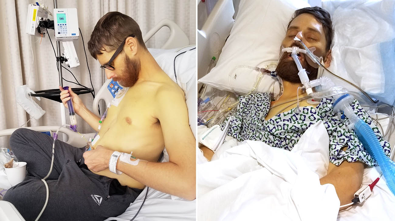 Andy Voge before his multi-organ transplant at Cleveland Clinic.