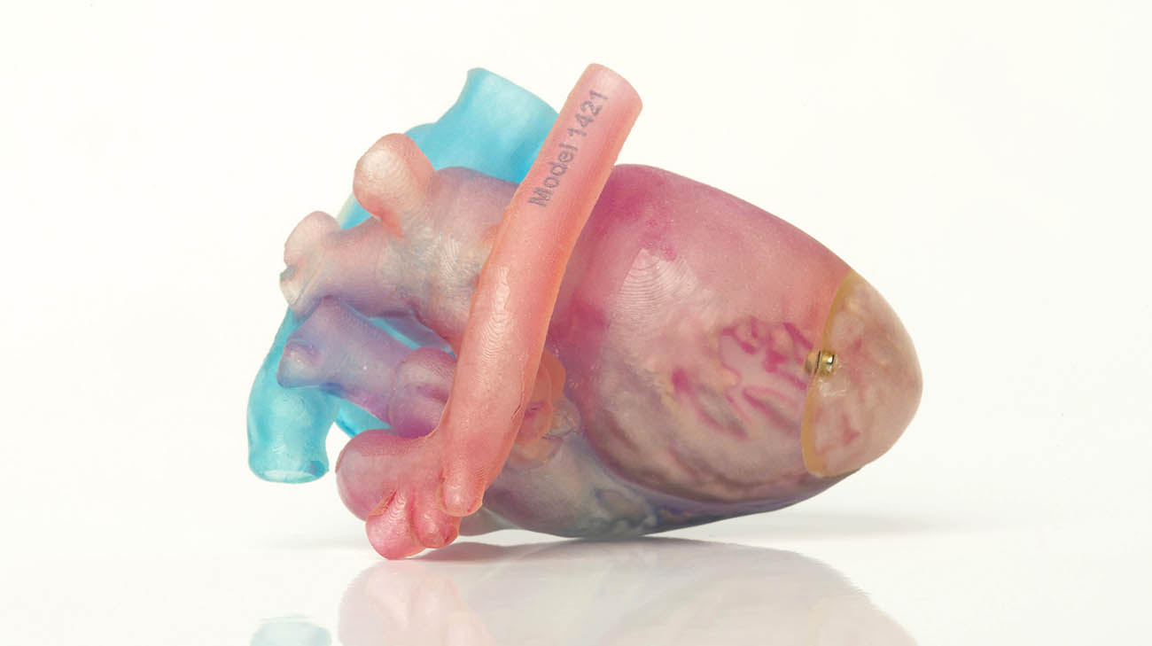 3D-printed model of DJ Edmonds' heart to guide Dr. Hani Najm prior to performing DJ's heart surgery. 