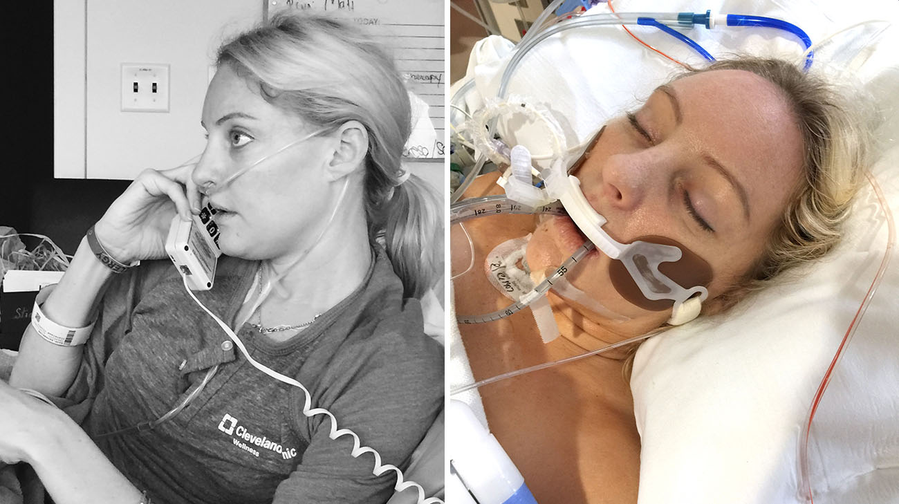 Kati Gregory before and after undergoing a double-lung transplant at Cleveland Clinic. 