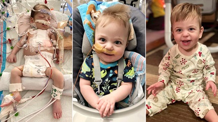 Photos show how Mikey's treatment for his congenital heart defect has progressed.