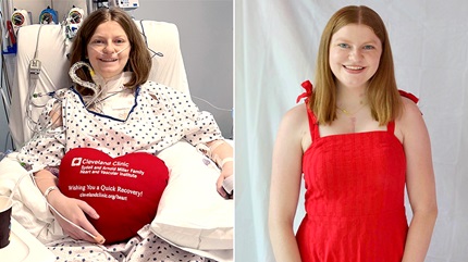 Katherine after heart transplant on left, Katherine during Heartiversary celebration on right.