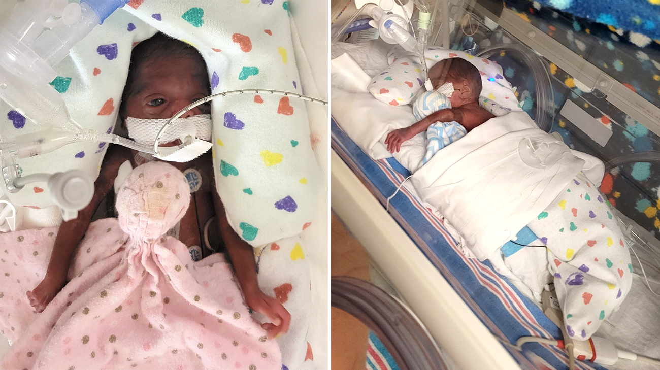 Defying the odds: Child born four months premature celebrates