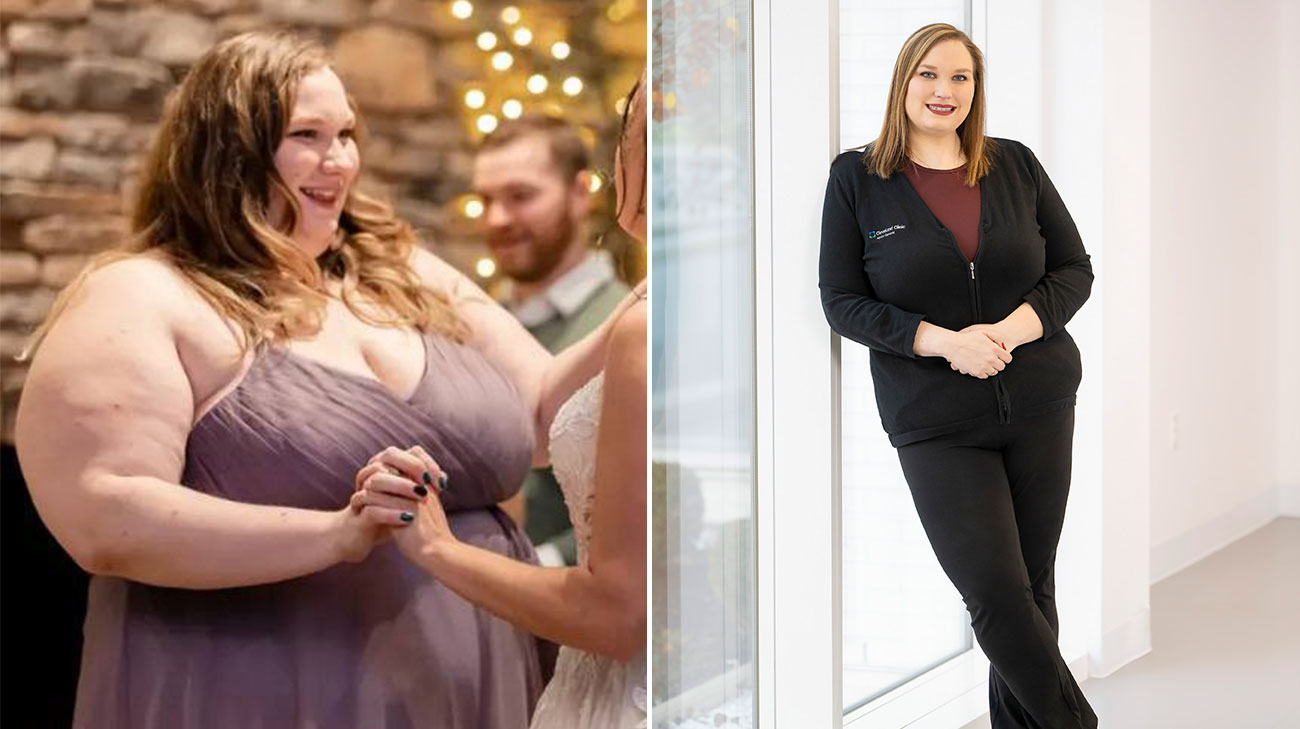 Before and after of Sabrina showing the results of her bariatric surgery.