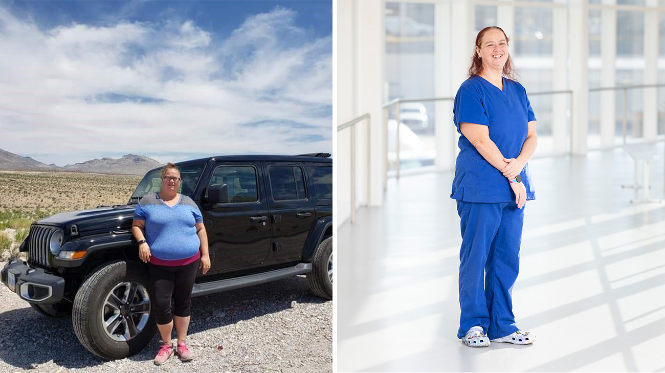 Jeananne Kilbel before and after her surgery.