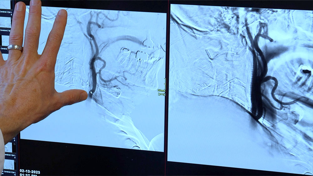 Hand holding up x-rays