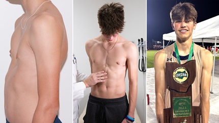 Caleb before and after surgery as well as him during track. 