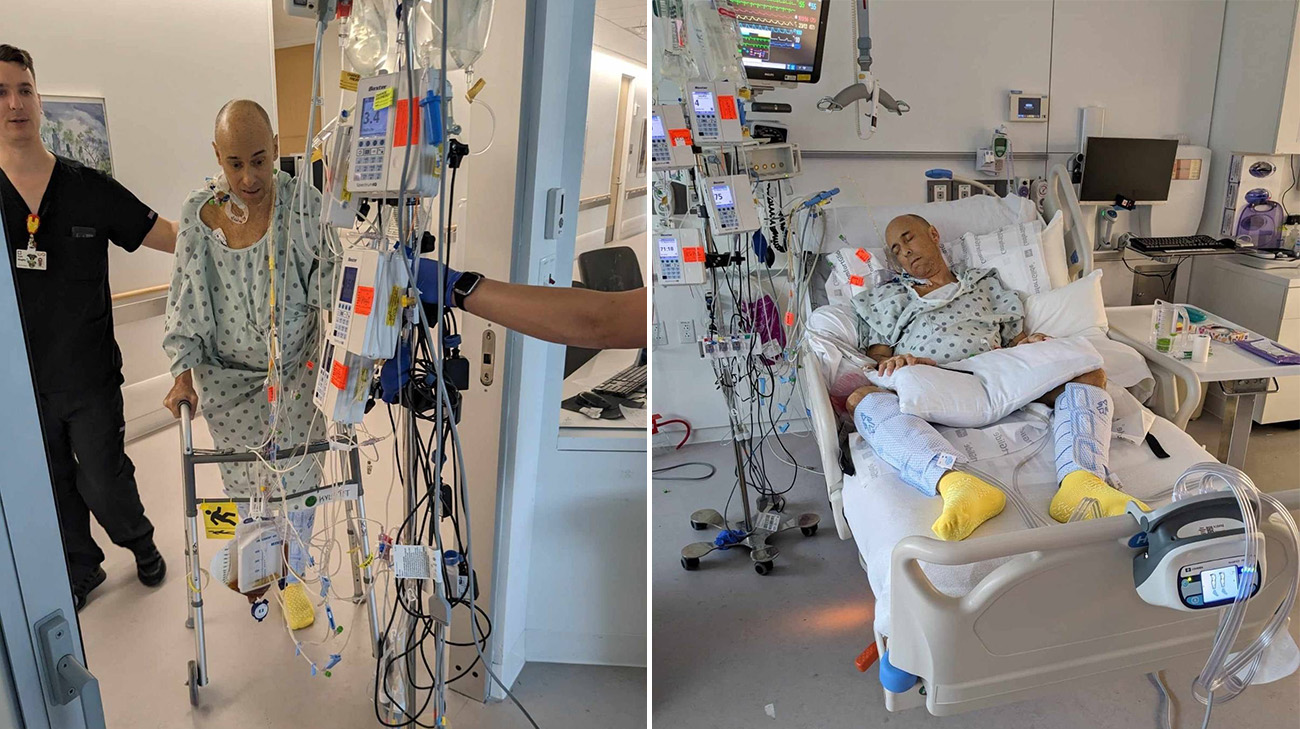 Left: Ken Hollander preparing for surgery. Right, Ken recovering after the transplant.