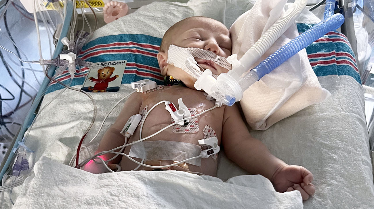 Lucy’s congenital heart defect was a condition called tetralogy of Fallot (TOF), which was paired with a less common problem called pulmonary atresia.