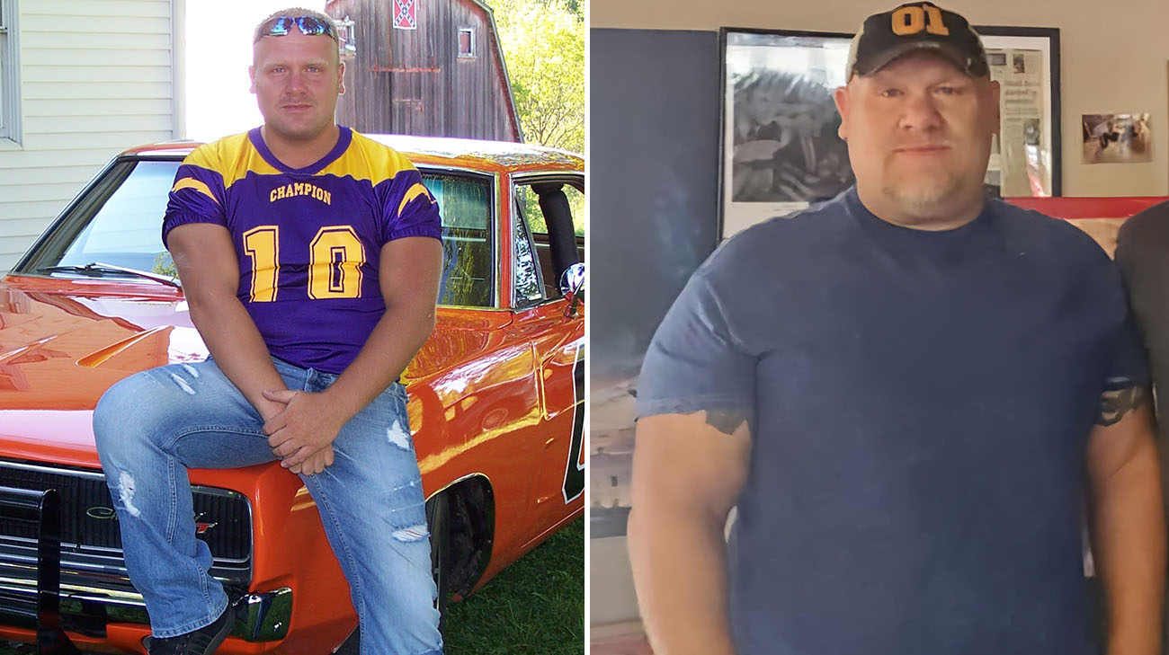 Ray before and after he developed a tumor from a condition called acromegaly.