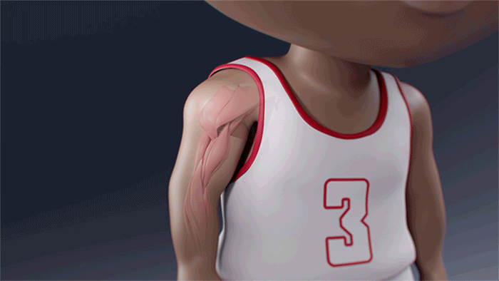 Medical animation of Myles' innovative orthopaedic surgery.