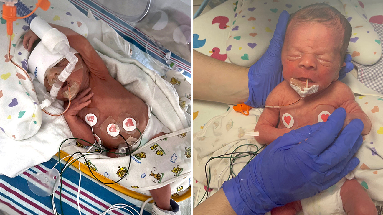 Sixx Carter Kline was born 11 weeks premature. 