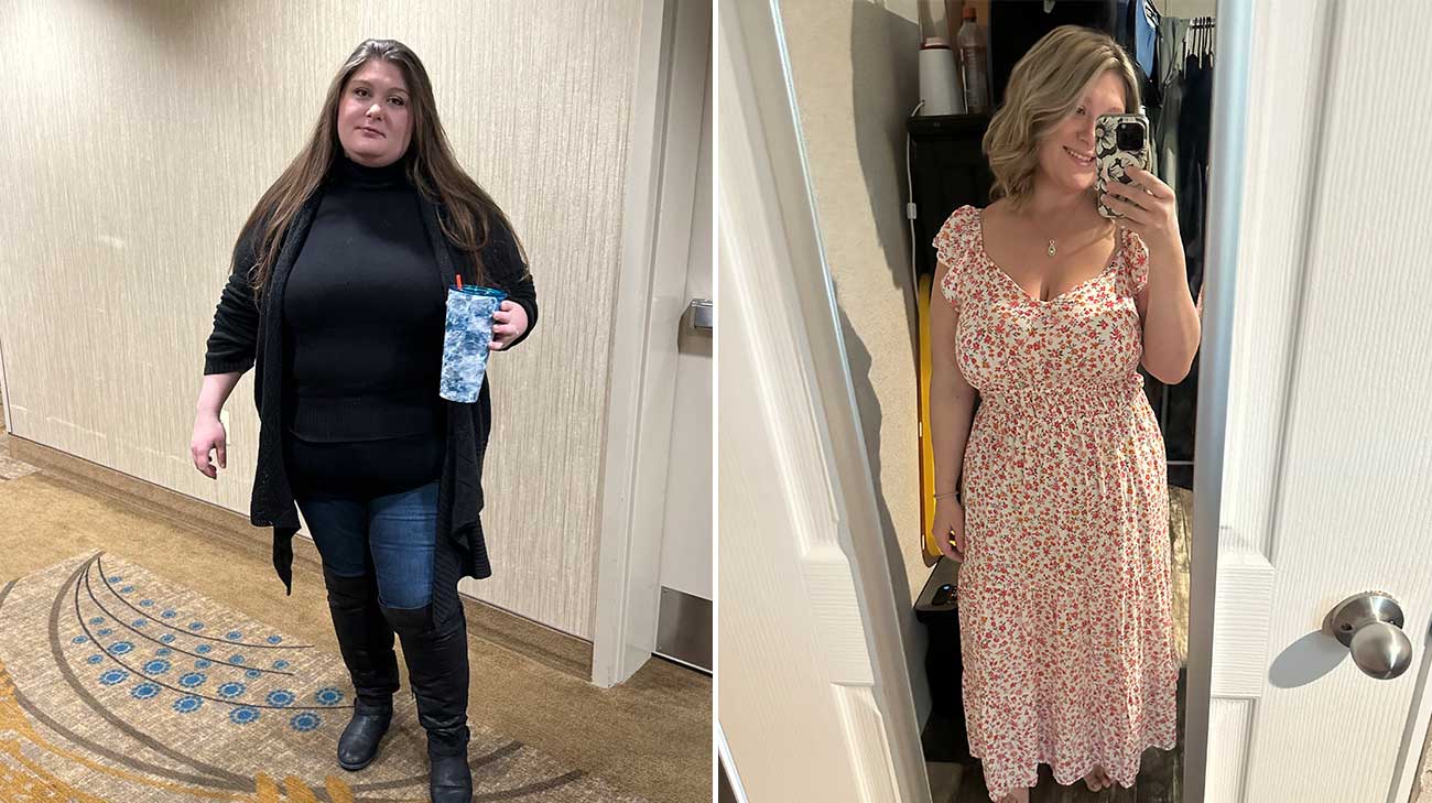 Kaitlyn before and after surgery.