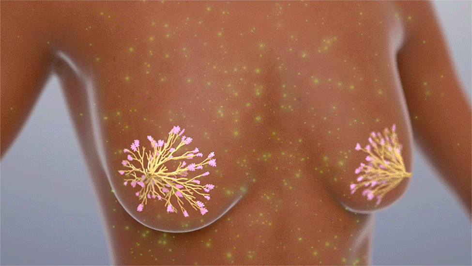 Cleveland Clinic breast cancer vaccine animation.