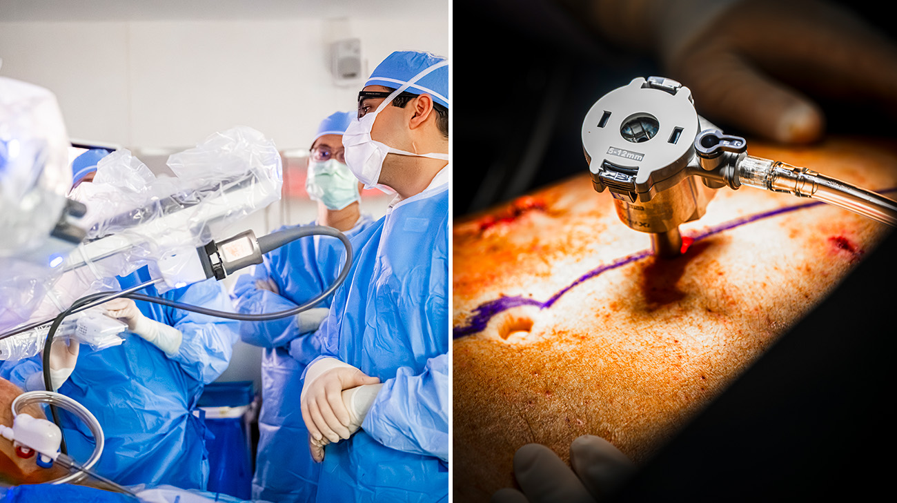 Cleveland Clinic liver transplant surgeon Dr. Alejandro Pita and the surgical team performing a robotic liver transplant. 