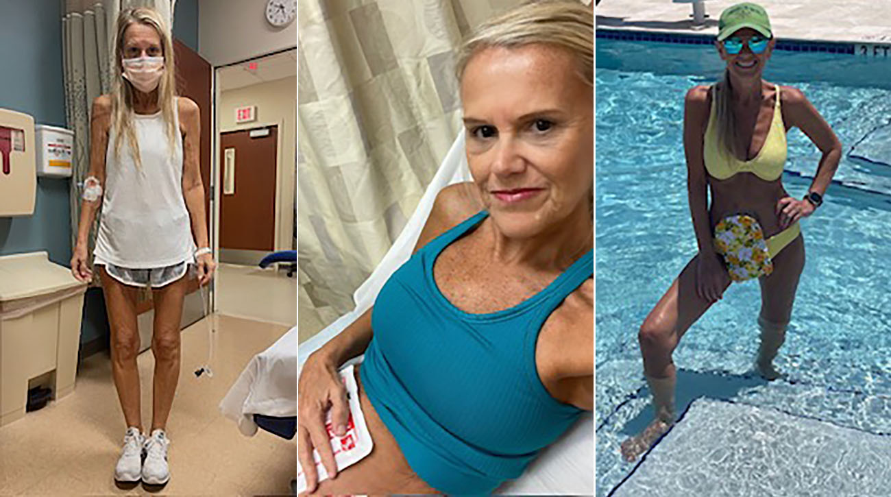 Susan Rosenthal patient story