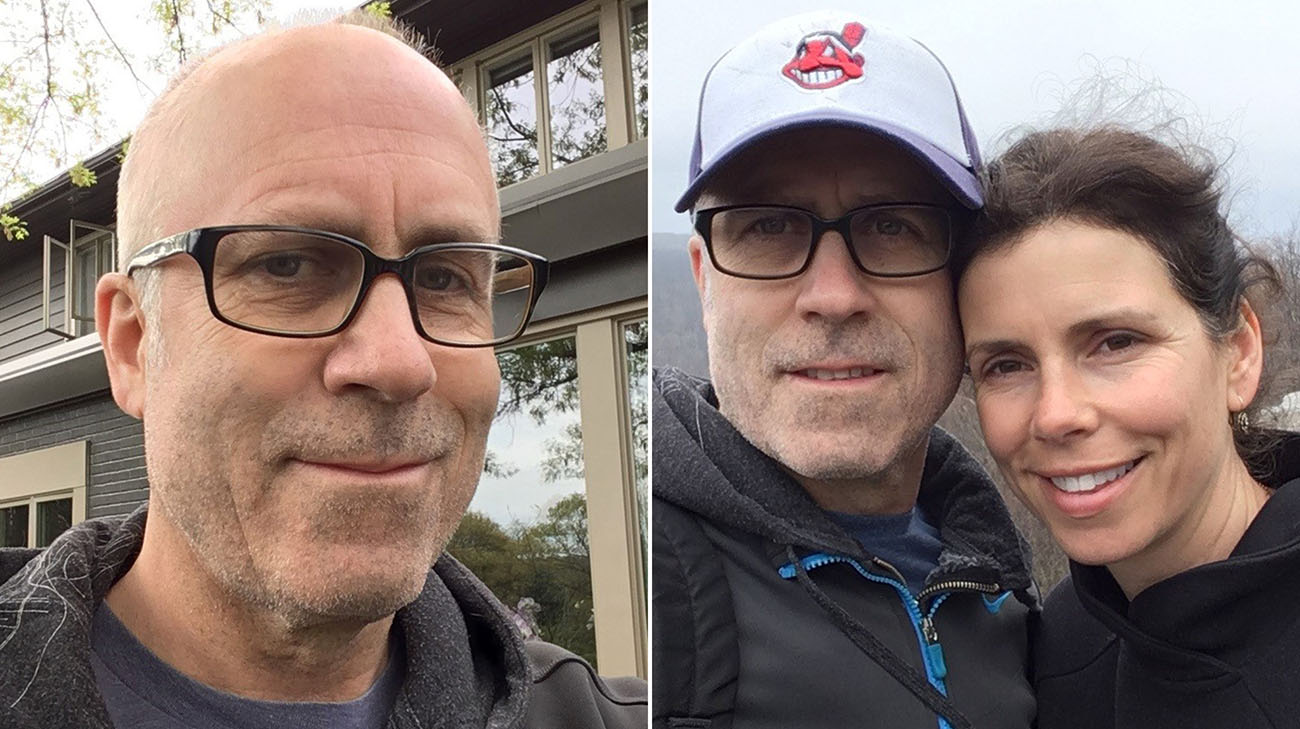 Jeff underwent six weeks of radiation, which caused him to lose his hair, before beginning the clinical trial. He says his wife, Cynthia, has been an amazing support throughout his journey. (Courtesy: Jeff Tabor)