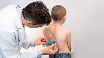 Game-Changing Treatment for Scoliosis
