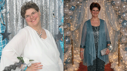 Cleveland Clinic Florida patient, Sharon Harmer, shows her weight loss journey from back in 2018 (left) to now in 2026 (right).
