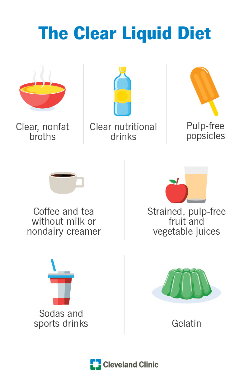 An infographic showing the clear liquid diet we recommend.