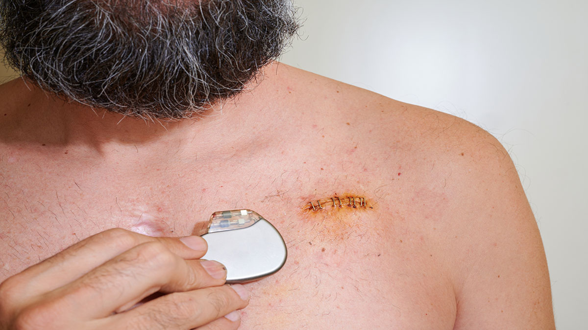 Patient Pacemaker 1