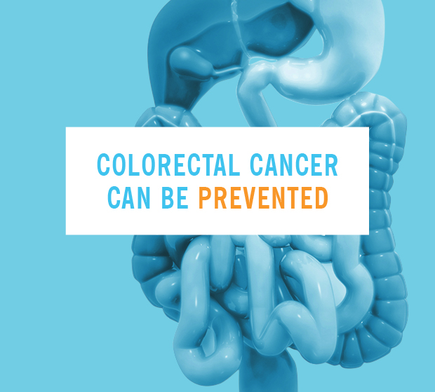 Colorectal Cancer Can Be Prevented
