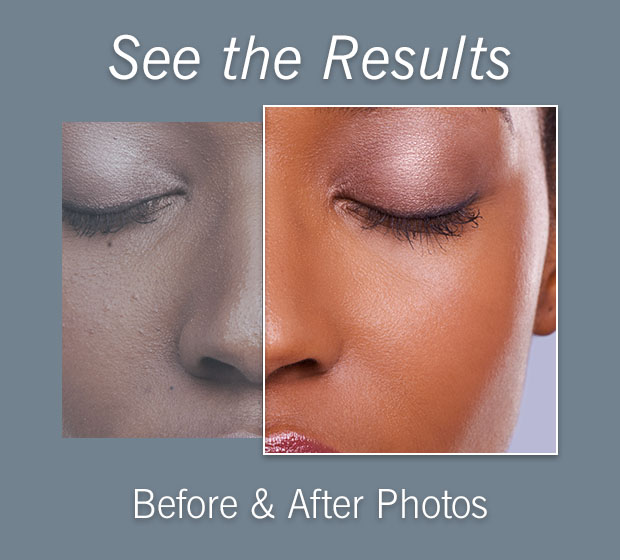 Before and After Photos | Cosmetic & Plastic Sugery