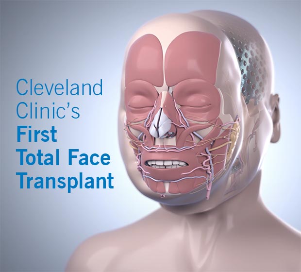 first-total-face-transplant