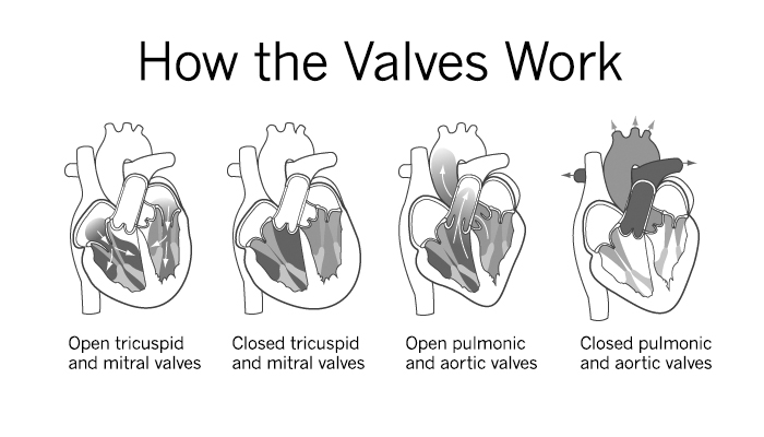 Heart Valve Surgery Valves