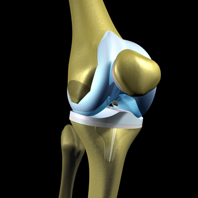 Knee Pain Treatment Guide | Cleveland Clinic