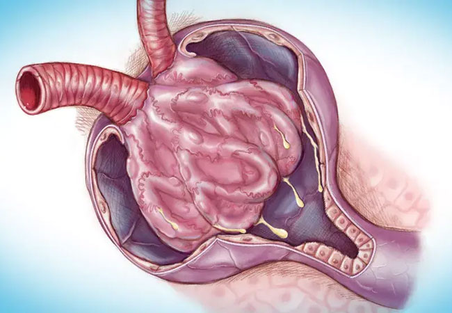 Illustration of glomerulus