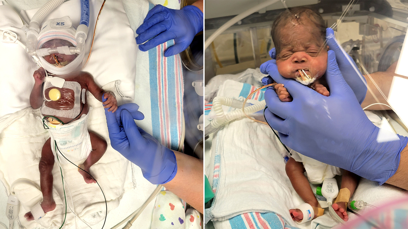 Kimyah and DJ when they were in the NICU at Cleveland Clinic. 