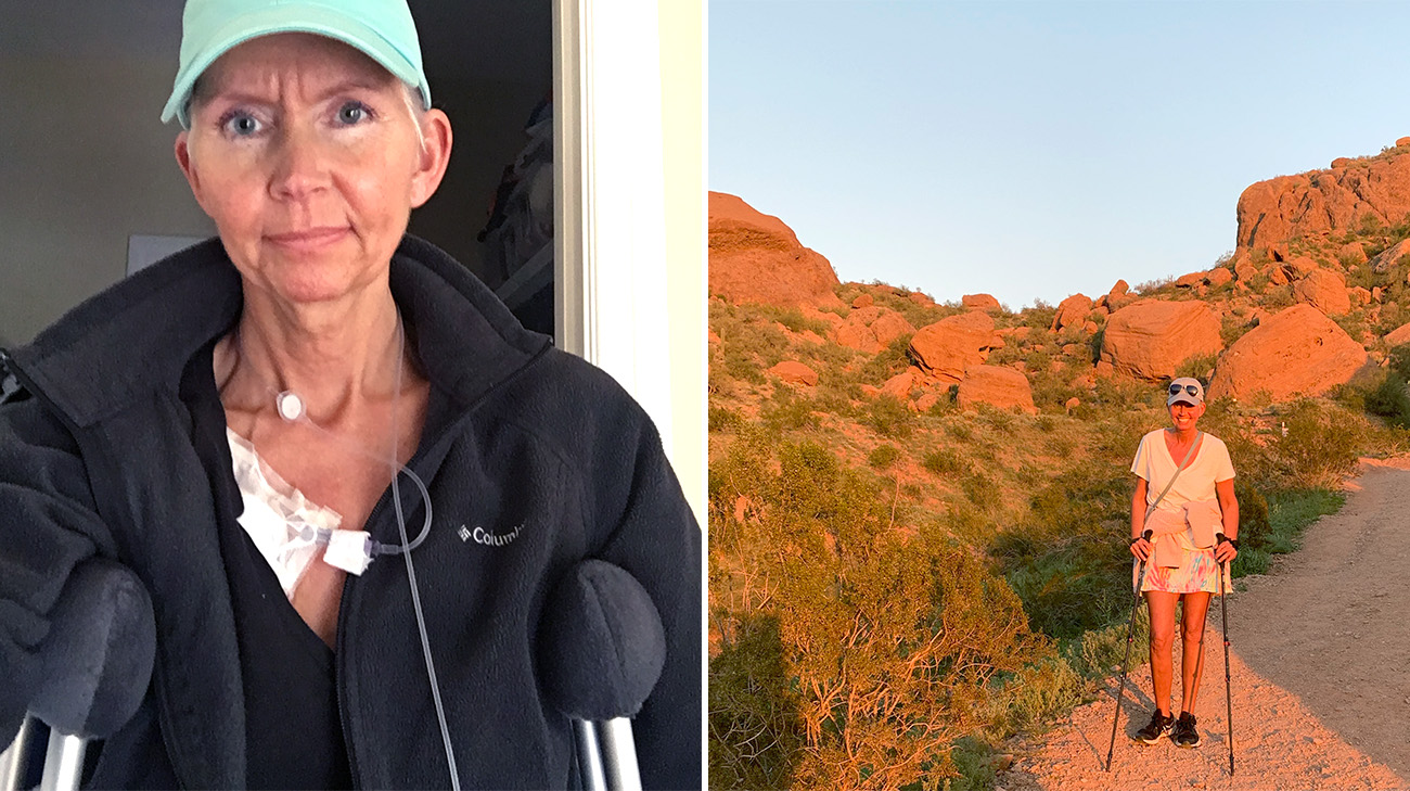 Claire recovering from broken bones