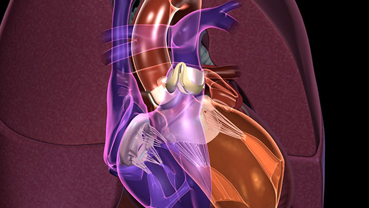 Heart Transplant